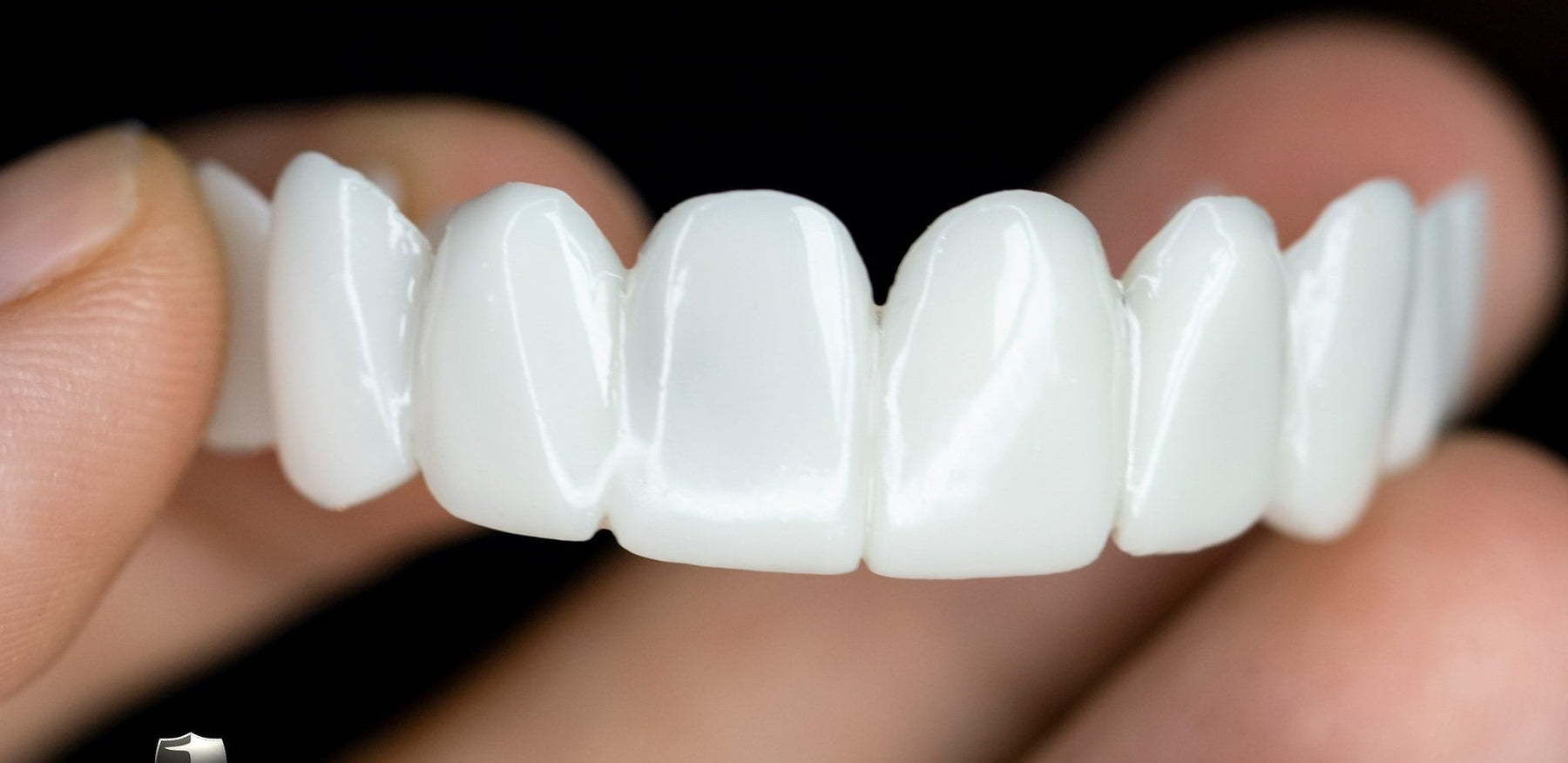 Όψεις Οδόντων DentAlign – Φυσική Εφαρμογή και Άνεση